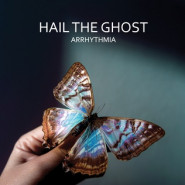 Arrhythmia