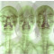 Supergrass